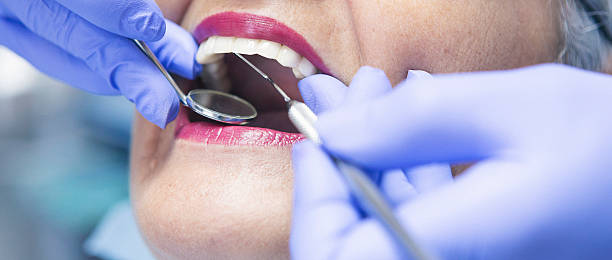 Best Emergency Tooth Extraction in Heritage Lake, IN